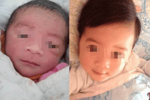 孩子刚出生长这样, 医生说道, 长大后会“变”美人坯子
