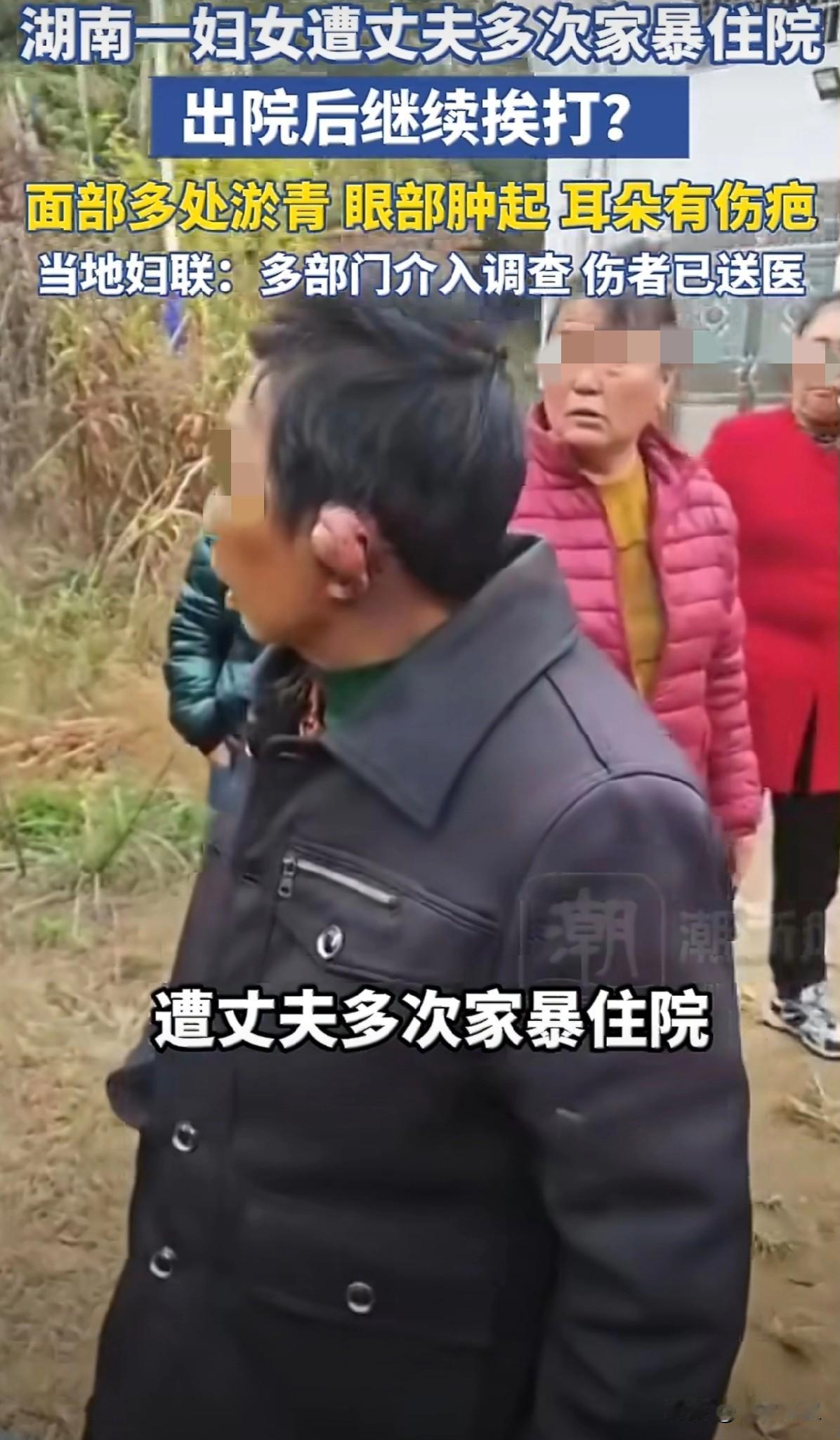 看到这样的新闻，心里真是堵得慌。湖南平江那位老人，脸和耳朵肿得不成样子。那种