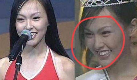 有人说唐嫣现在这么显老是因为做医美加微调了。我觉得有点道理，除了她早期的图片