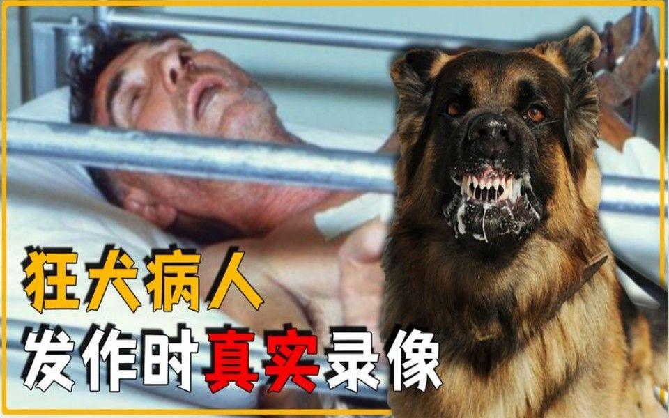 狂犬病发病后真的可以存活吗?这么说吧，狂犬病发病后的存活概率几乎等同于奇迹。