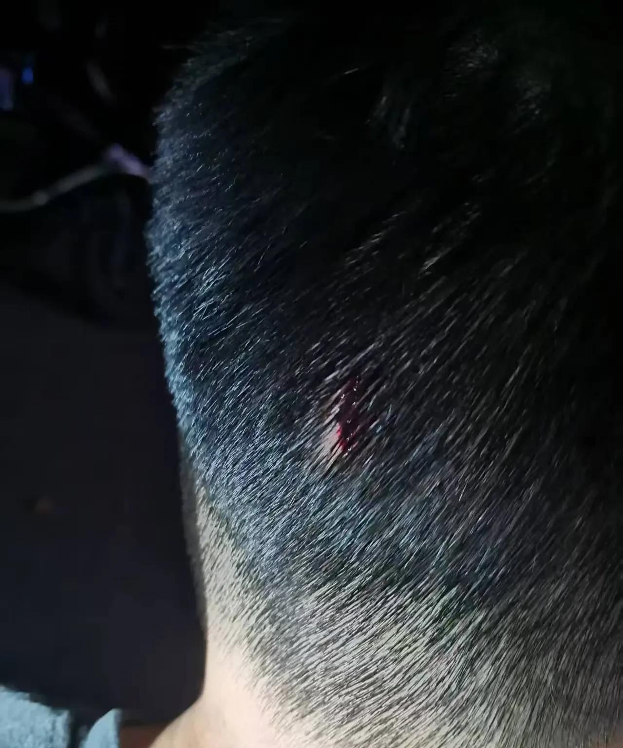这就是我不放心让老公带孩子的原因。昨天晚上9点多我还在外面，当时我在等红绿灯，