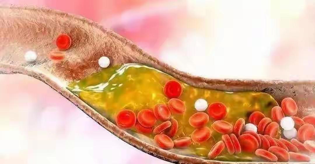 “血脂高没高看嘴唇？医生忠告：嘴唇有2个迹象，你的血脂或已超标”✅嘴唇真的能反