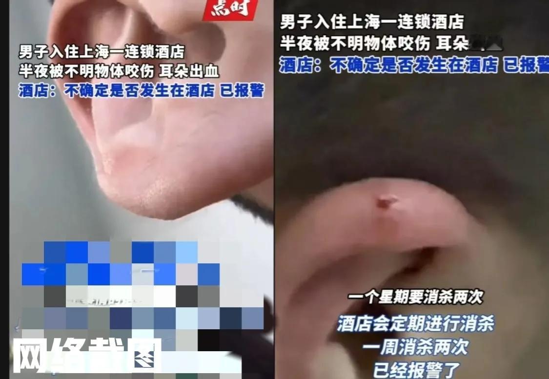 上海有男子入住酒店休息。只在男子晚上睡觉时突然感觉到自己像被什么东西咬了一样