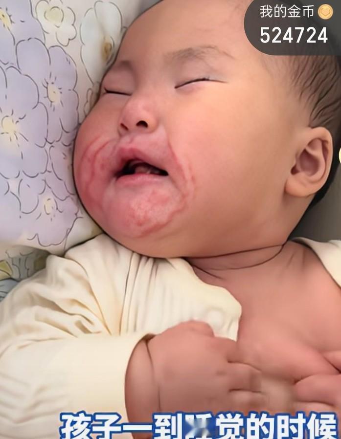 孩子一到睡觉的时候，浑身痒，长满湿疹，难受到睡觉都不安稳，直接大哭，这湿疹