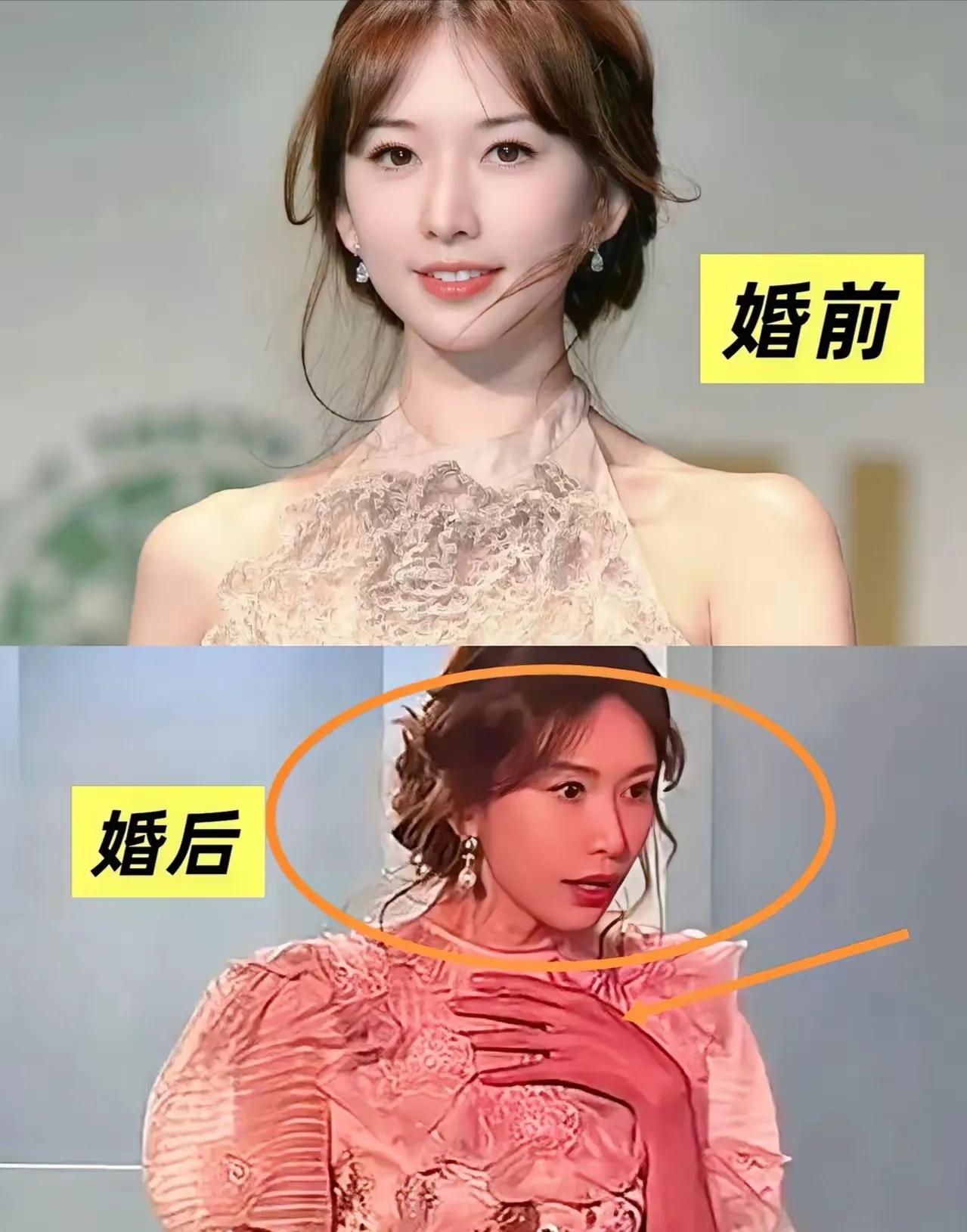 网上一直流传林志玲被日本老公家暴，还只能忍气吞声。从最近的照片来看，林志玲好像