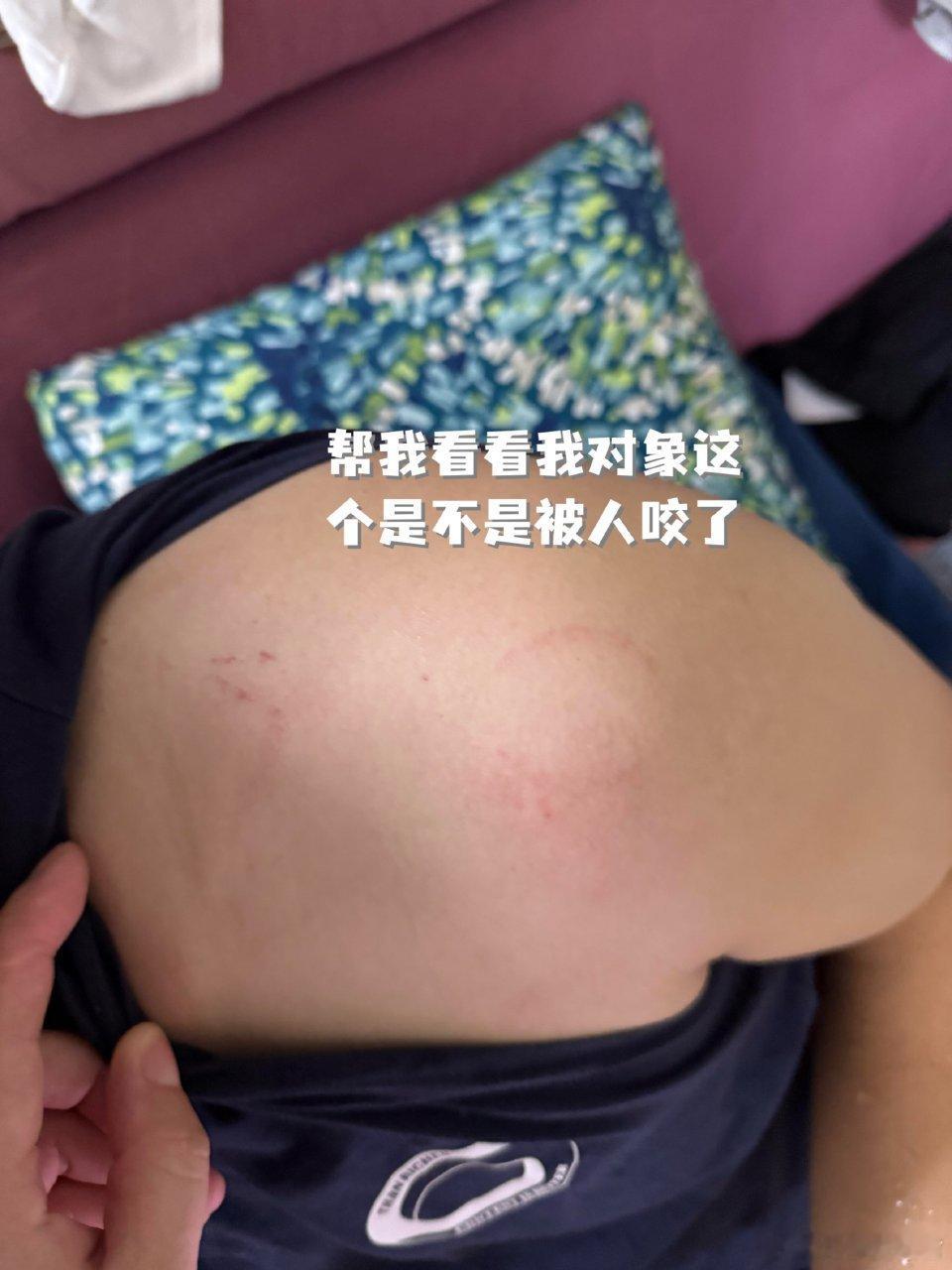 各位姐妹们，麻烦帮我看看一下这个是咬的吗❓​​​​