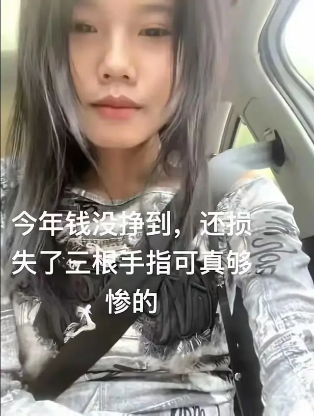 女孩三根手指被压断后续, 赔偿遥遥无期, 网友热议