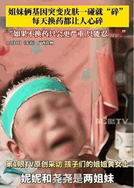 太心疼这两个小姐妹了。除了睡觉，每时每刻都在痛，每天都有新伤口长出来。这两个小