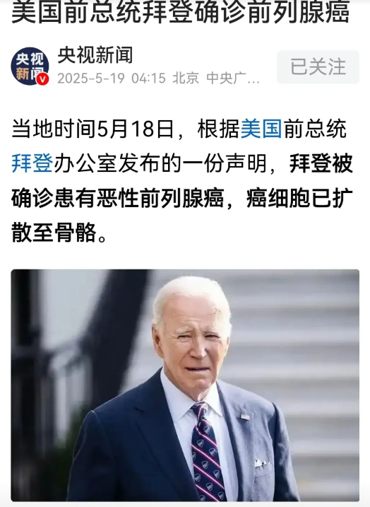 82岁拜登确诊前列腺癌：上周拜登因排尿症状加重就医，医生检查发现其前列腺出现新