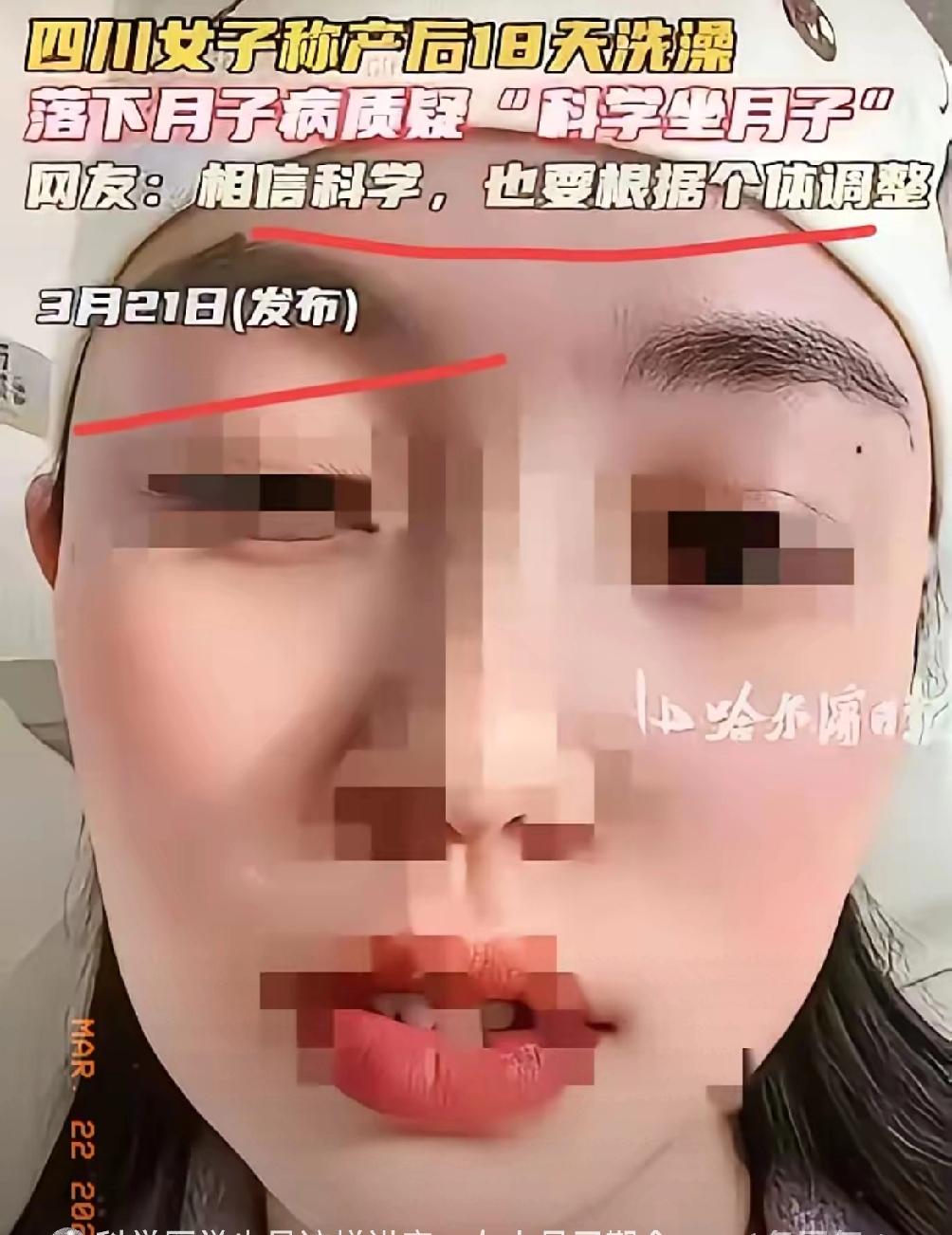 95后宝妈盲信“科学坐月子”跌入坑！产后18天洗头受凉，月子病缠身半年