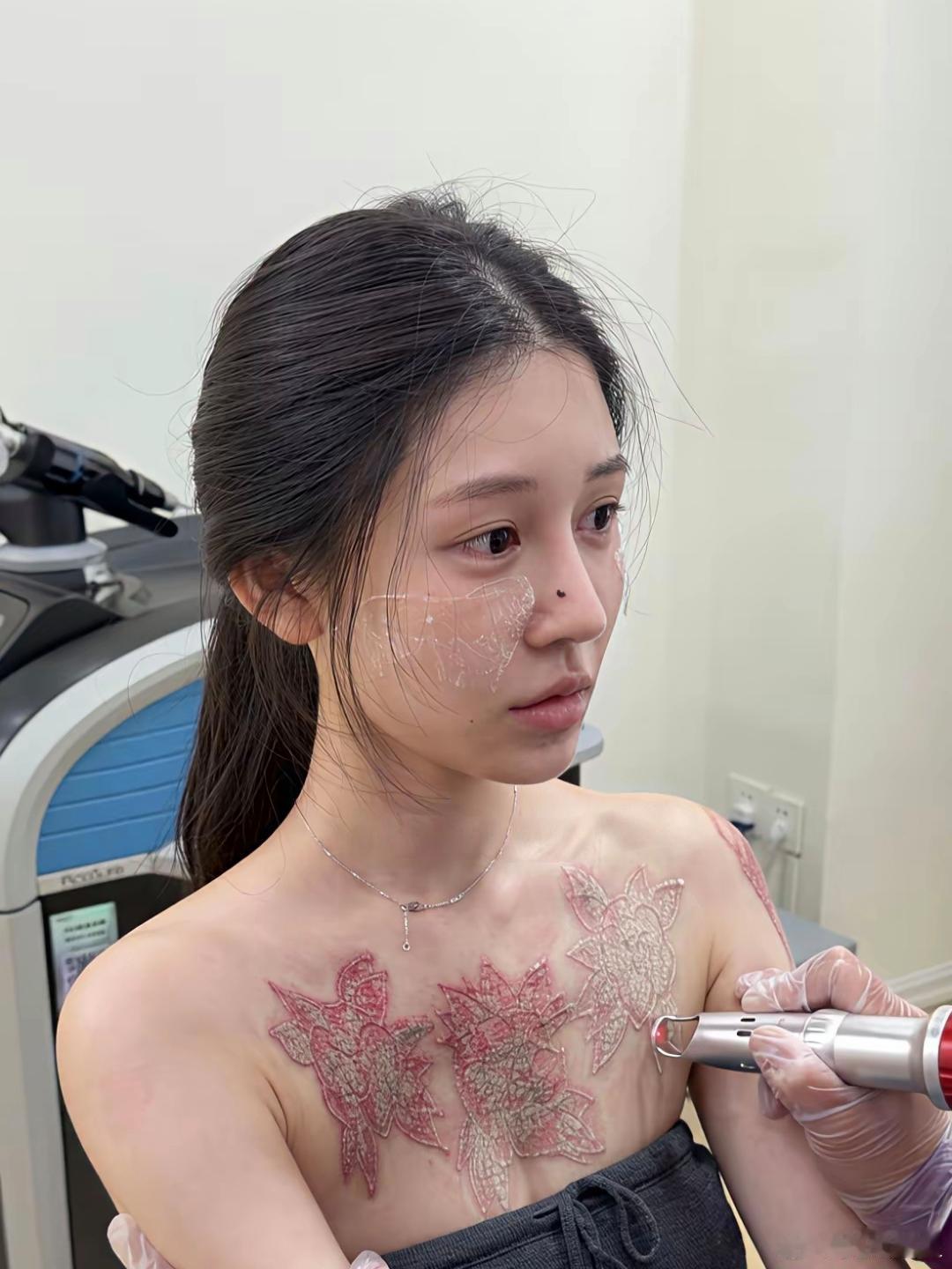 纹的时候一时爽，现在后悔了吧