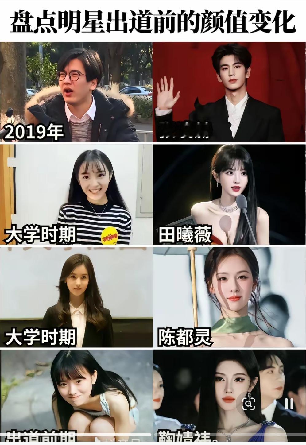 有钱真是最好的医美！看这些明星出道以前也和普通人一样！