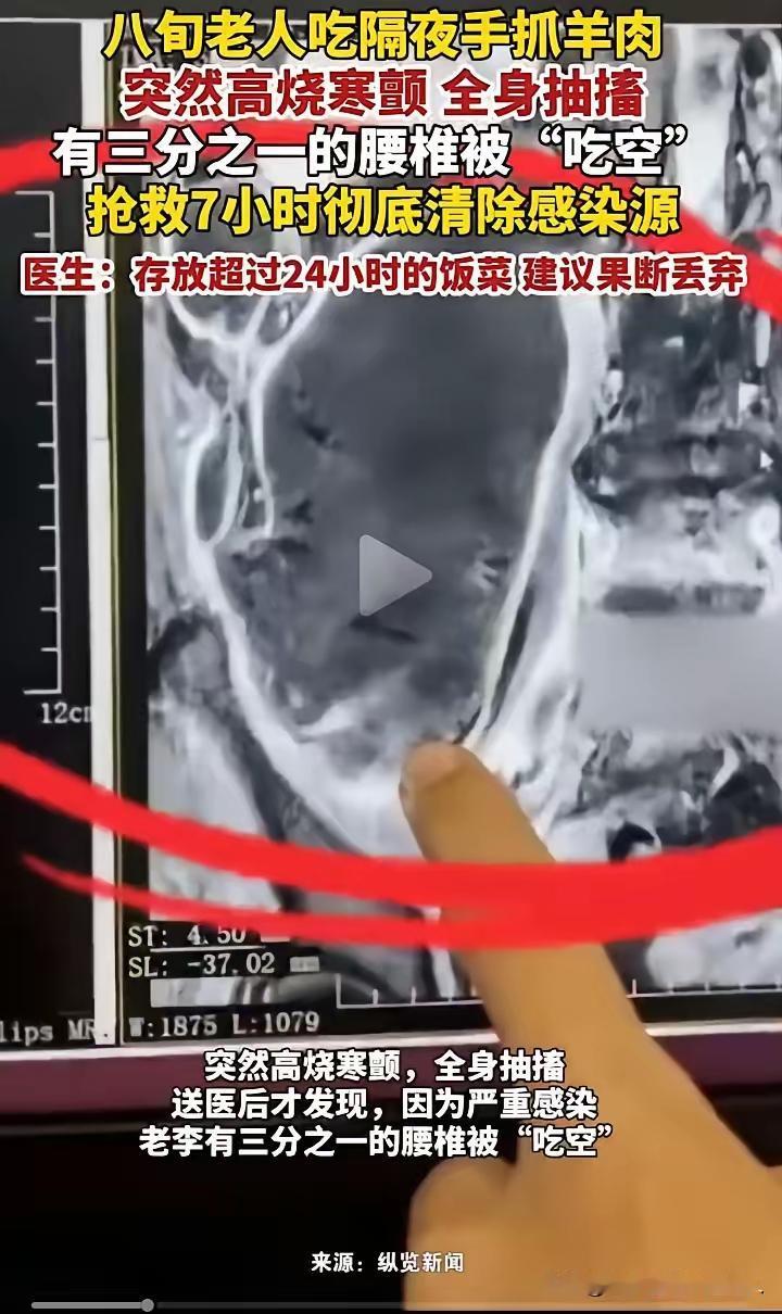 太吓人了!西安82岁老人打包的手抓羊肉放冰箱两天,热过之后吃下去,直接高烧