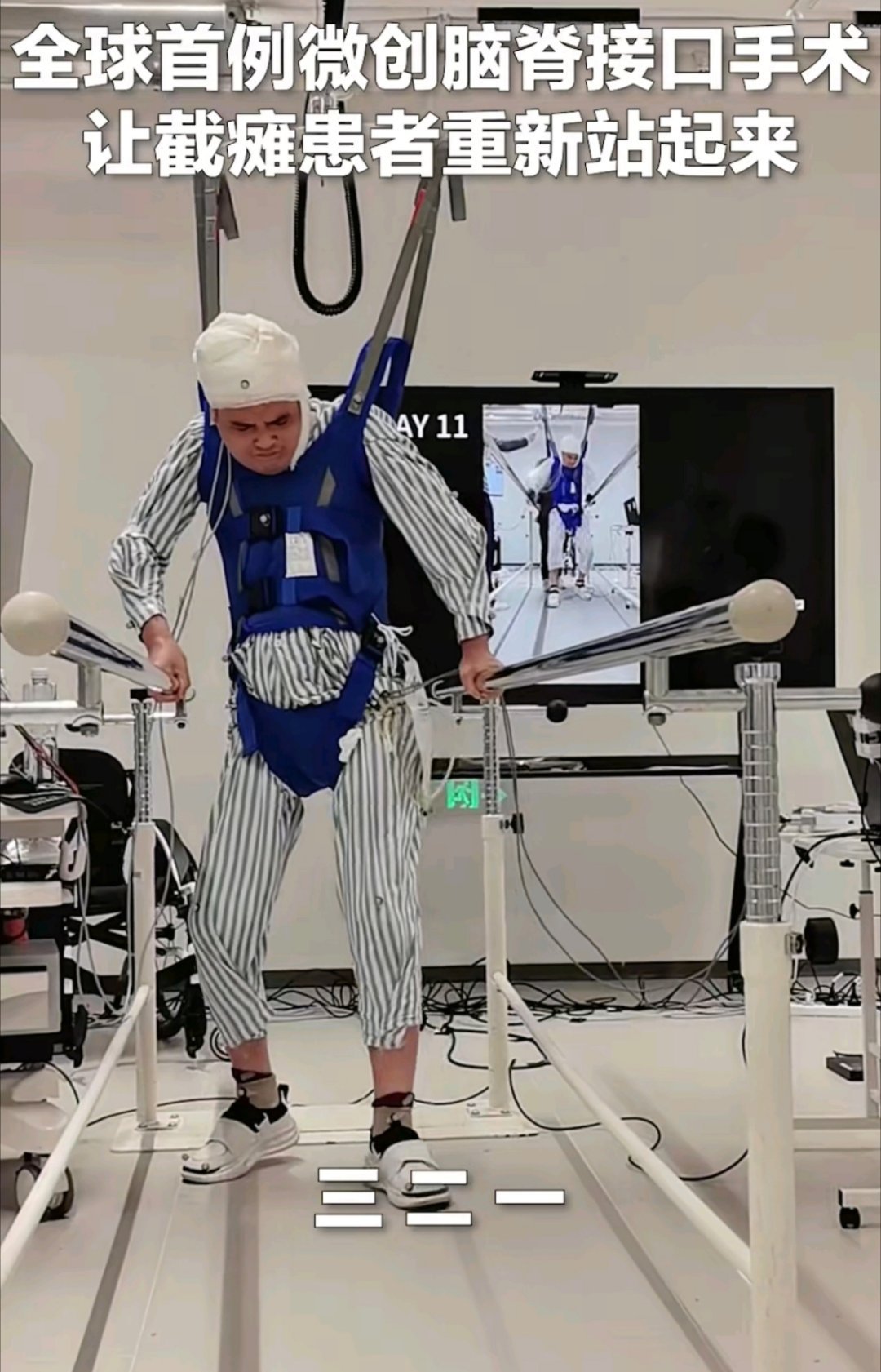 你别觉得脑机接口听起来很高科技跟我们大部分人没关系，其实现在已经慢慢在投入运用了