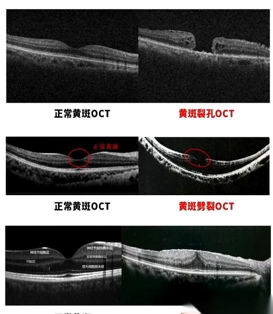 往眼睛里打针，这事儿光听着就够吓人的吧？但为了那点儿快要保不住的视力，看东西不