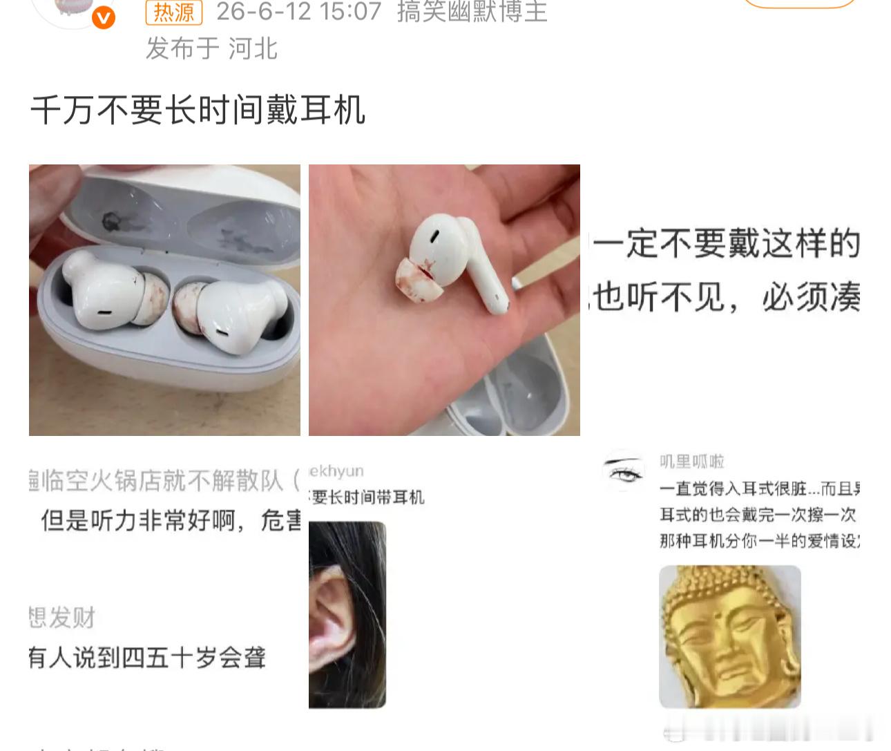 千万不要长时间戴耳机：这个确实不建议，长时间戴耳机会得中耳炎还会影响你的听觉，如