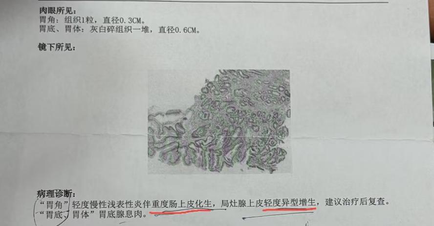 萎缩性胃炎伴肠化生，别再盲目乱吃药了，我用一经验方帮你修复胃粘膜很多人查出肠化