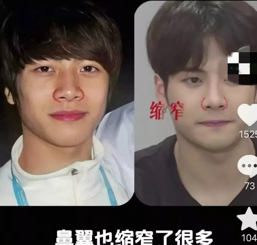王嘉尔被曝出做过调整，没想到也不是原生脸啊