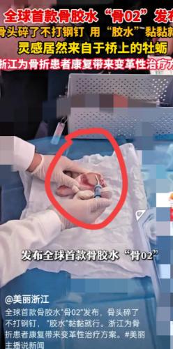 太牛了！骨折打针就能好？这下真的火出圈了。不光在国内，全世界都开始讨