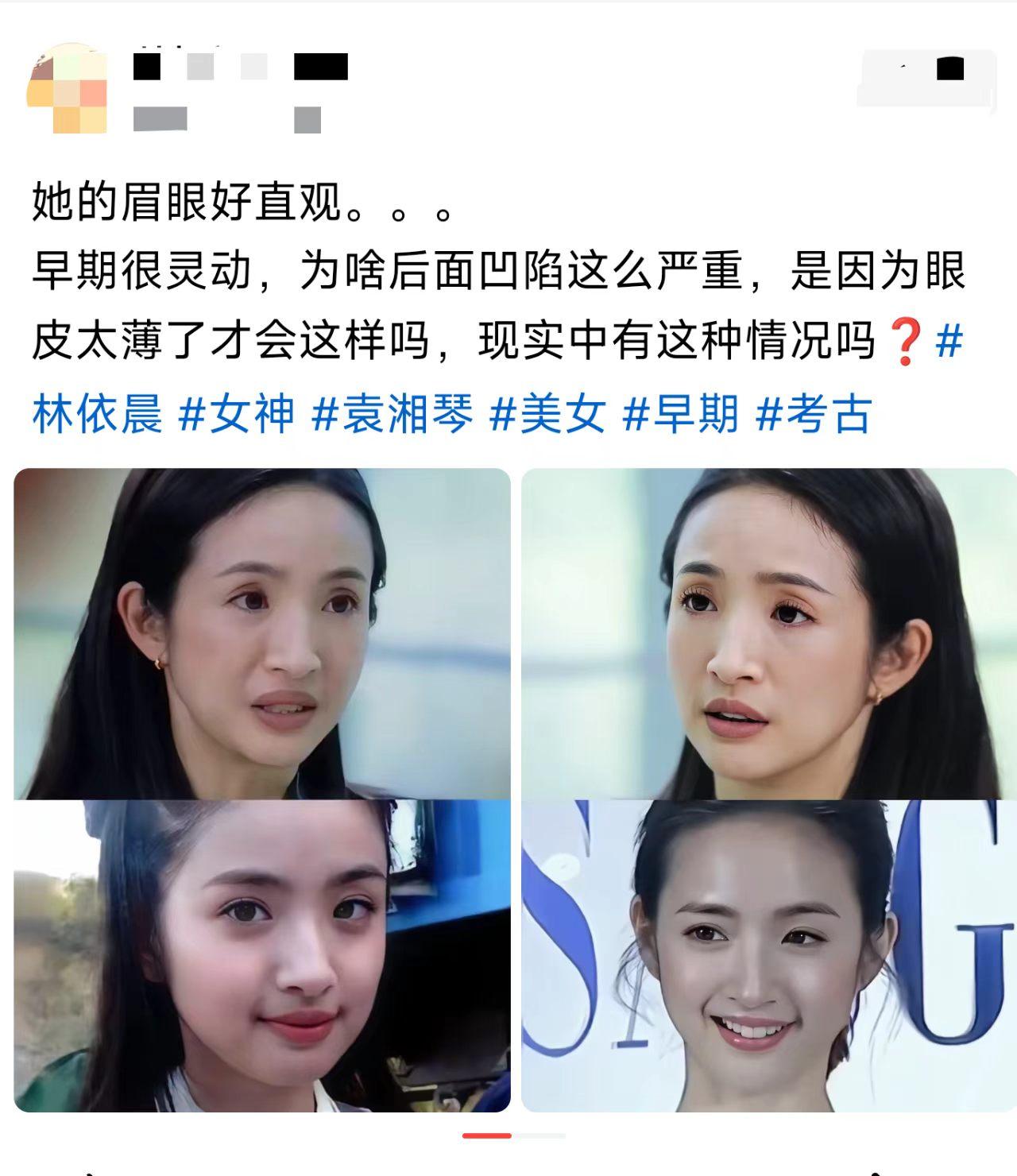 她是不是减肥太狠了？脸都挂不住肉了！