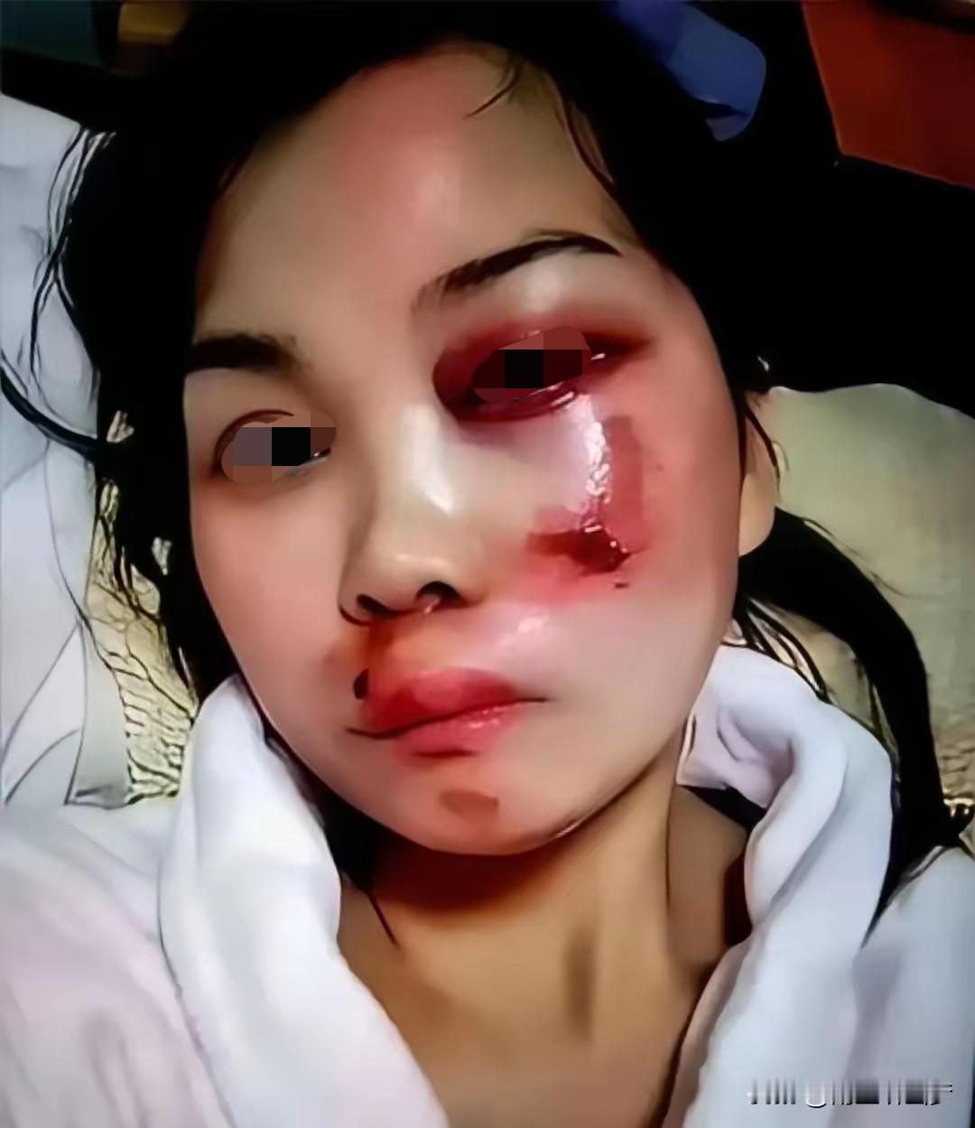 襄阳刘女士这跟头栽得够狠。躺在医院里疼得哼哼时，她会不会想起：当初嫌第一任老