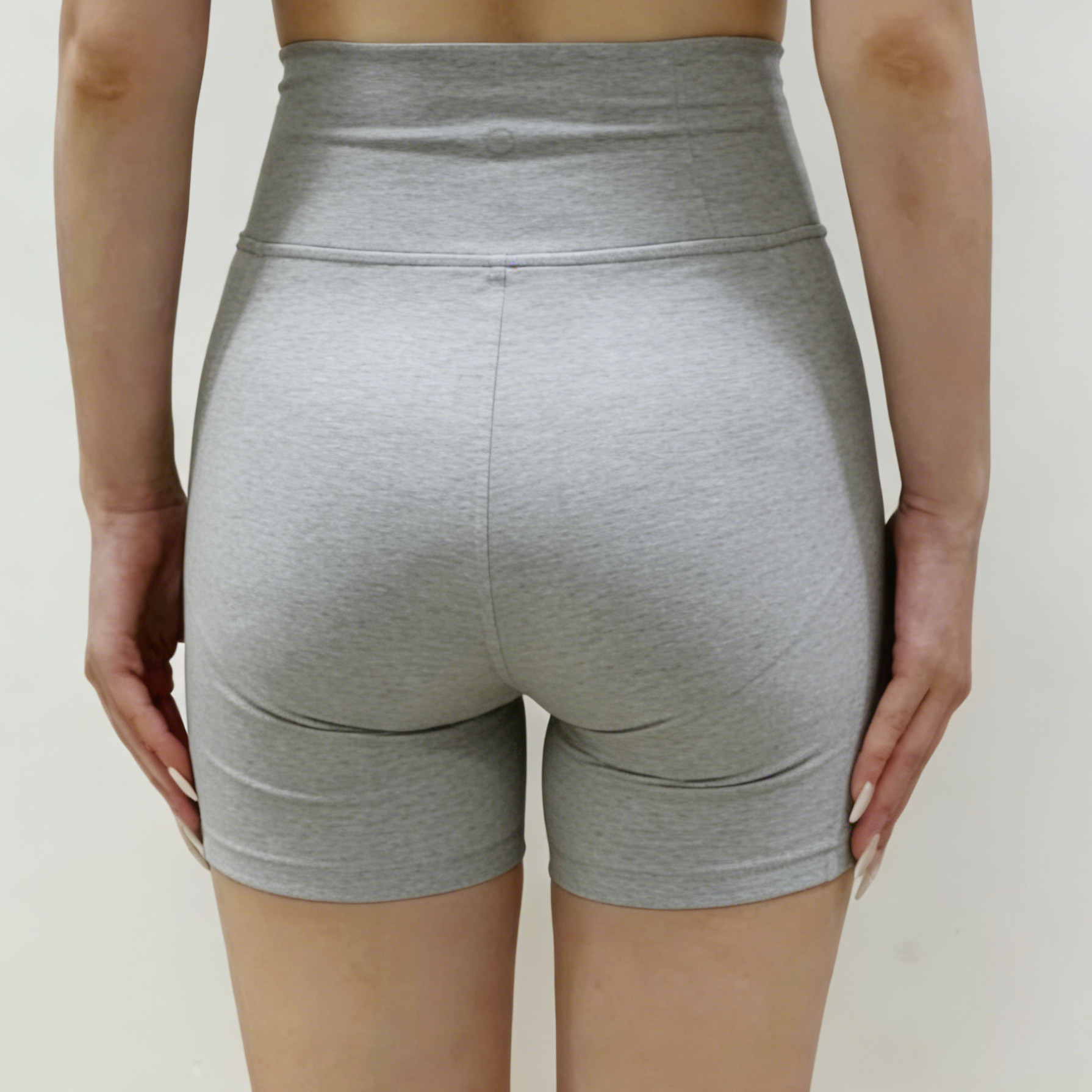 一个观察：骨盆侧倾或者不对称的朋友，「臀横纹」也可能一高一低，或者一边明显、一边