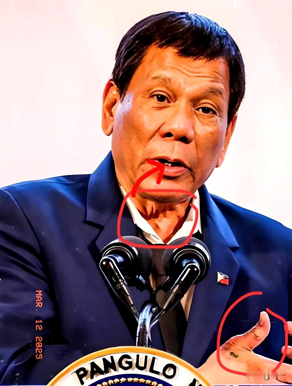 2026年1月26日，国际刑事法院正式裁定，80岁的菲律宾前总统杜特尔特身体状况