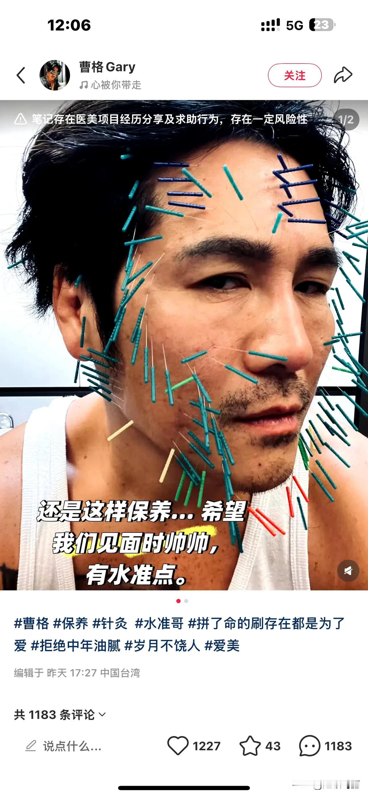医美界到底能整出多少幺蛾子[捂脸哭]对曹格的印象还是醉酒打人无数次戒酒失败又给