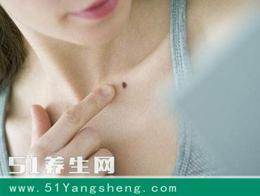 别再嫌弃你身上的痣了, 多痣原来对身体有三大好处!
