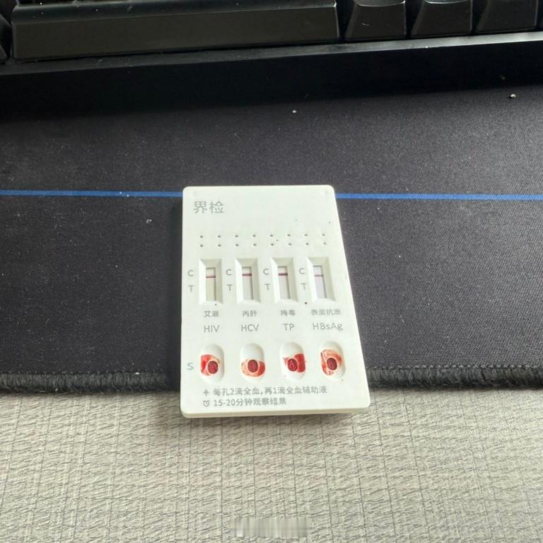 hiv检测发现现在的直男也很会注意安全，他们都知道四联试纸检测呢。咱们基友更要