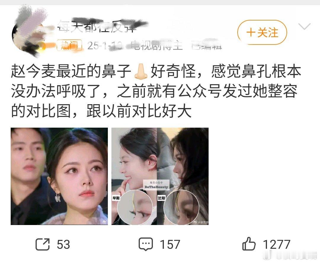 #赵今麦#赵今麦确实上过手术台不过是23年前医生抱着她告诉她的父亲“母女平安”​