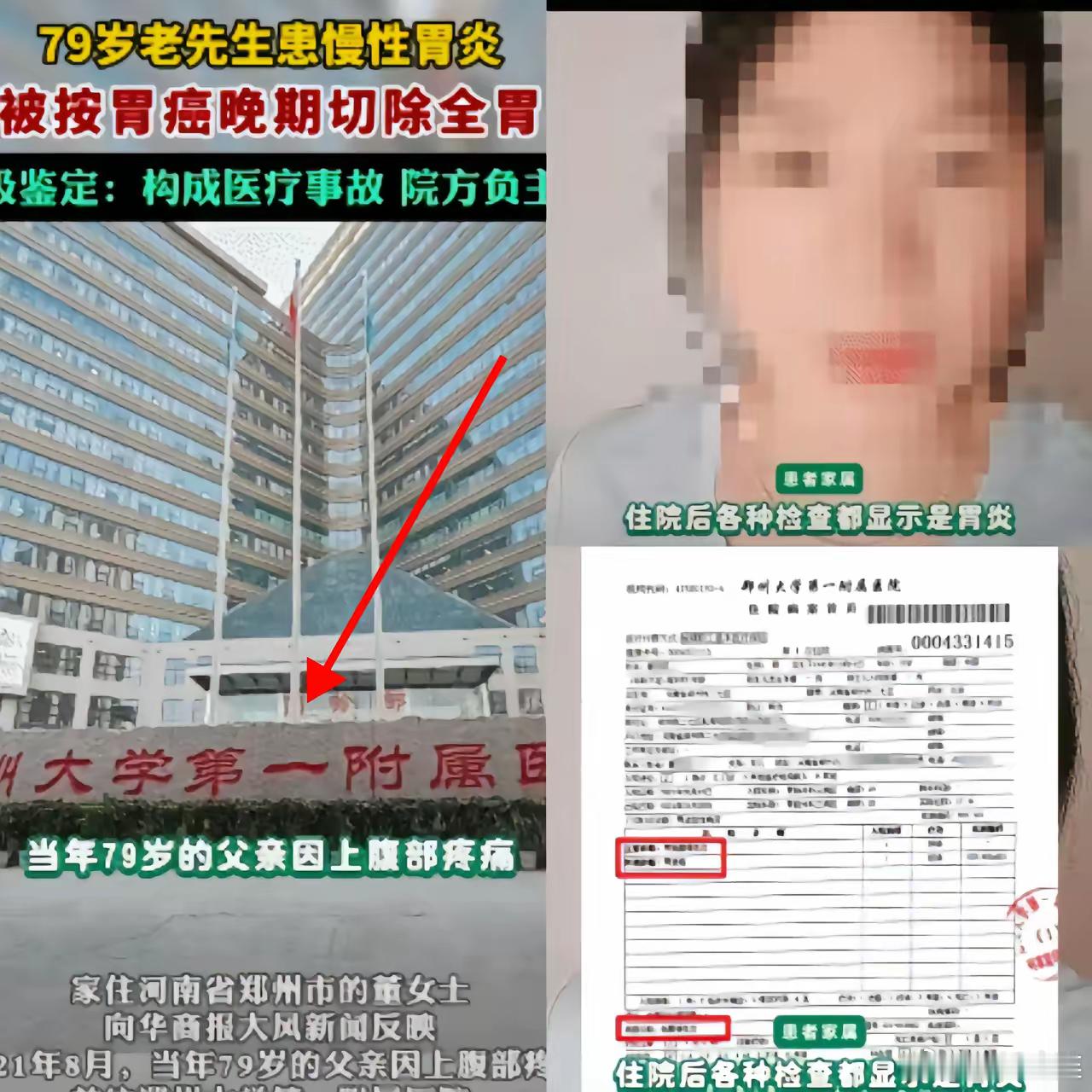 惊郑大一附院出大事了！​在二七区建设东路1号，一位患有慢性胃炎的患者竟被当成胃癌