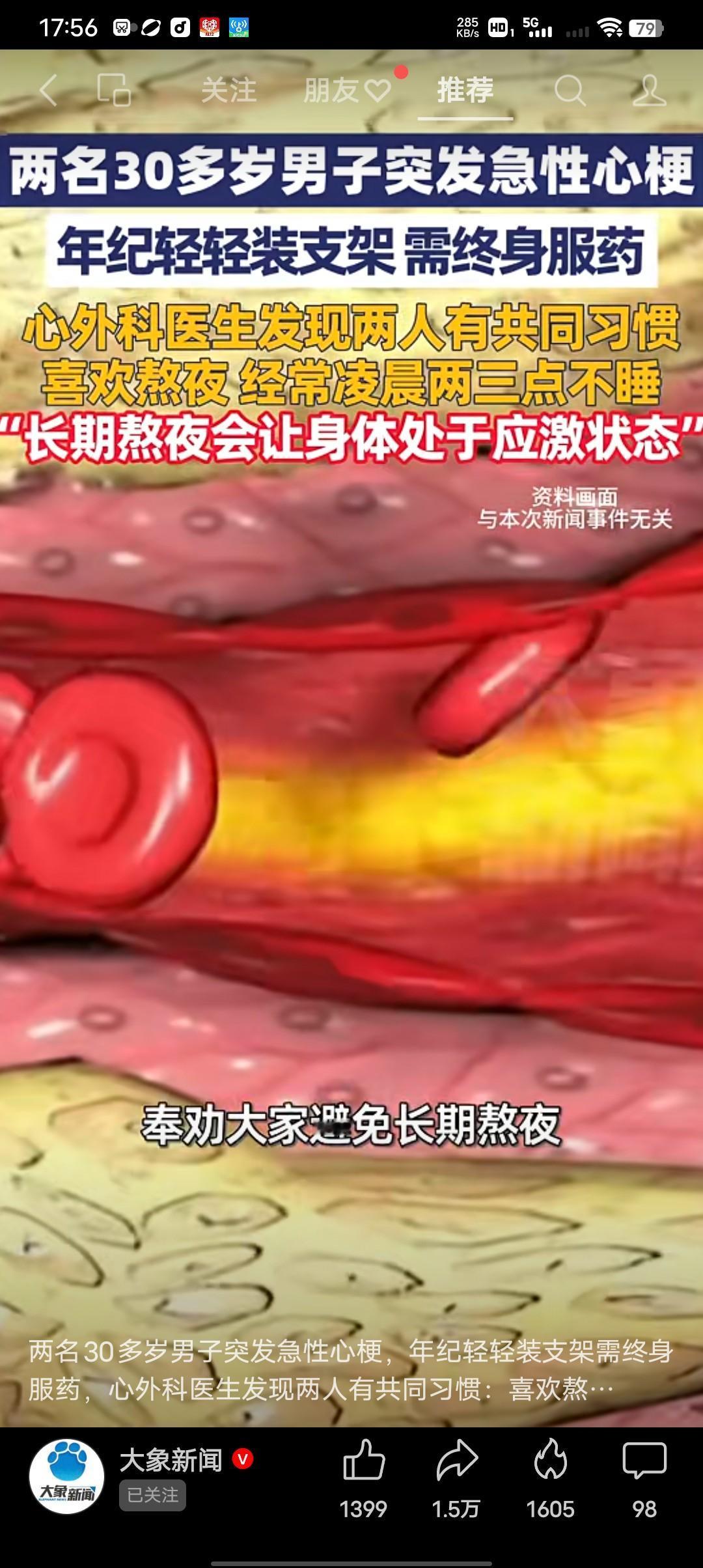 是什么原因造成30岁的男子患急性心梗呢？两名30岁男子突发急性心梗，河南省胸科