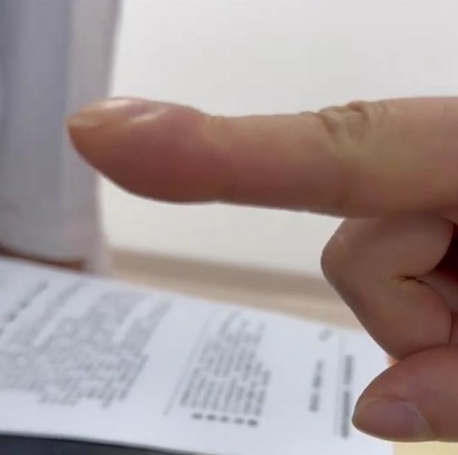 手指出现这种异常，可能是肺癌发出的信号！最近门诊接诊了一位40岁的男患者，印象特