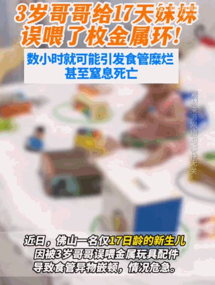 家长太大意了！广东佛山，一3岁哥哥将一枚直径1.4厘米的环形金属玩具塞入妹妹口中