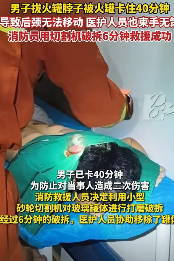 “太离谱了！”湖南浏阳，男子去拔火罐，没想到火罐把脖子卡住，根本拔不下来，医生也
