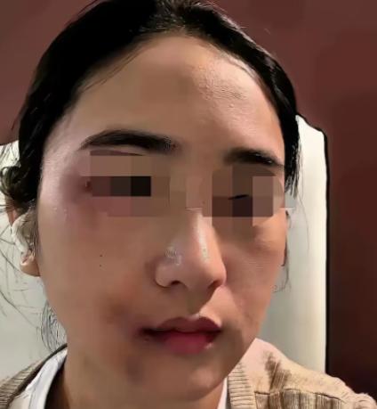 丈夫长期对妻子实施家暴，刚打完妻子没几天，自己却被查出肝癌晚期。家人要求妻子拿出