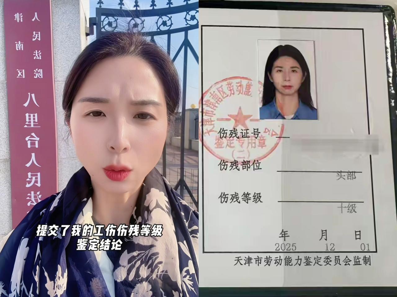 崔丽丽还是没有死心，她再一次向法院提交伤残鉴定，已经在等开庭通知了。看这情形