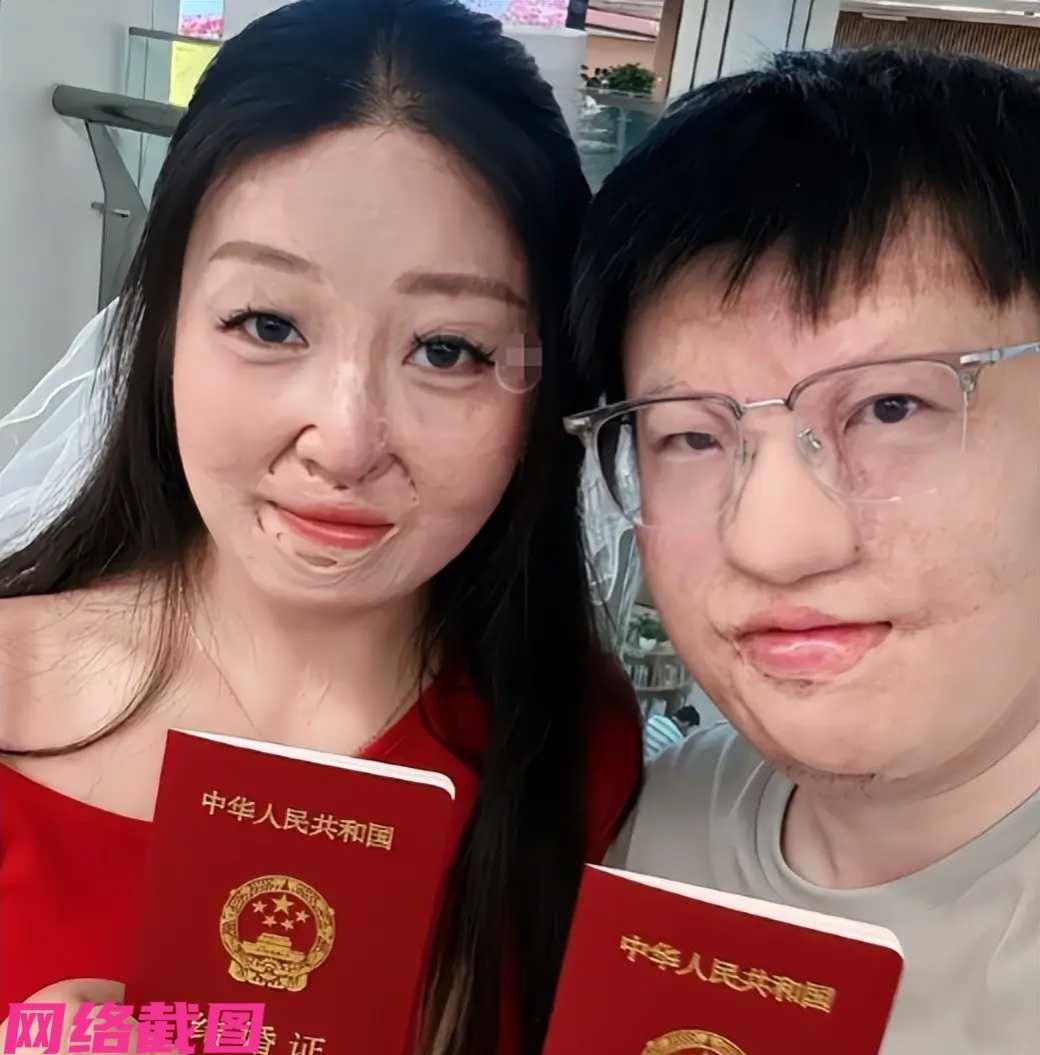 浙江杭州有情侣的527晒的结婚照，引人瞩目，她们彼此都有小时候留下的创伤痕迹，只