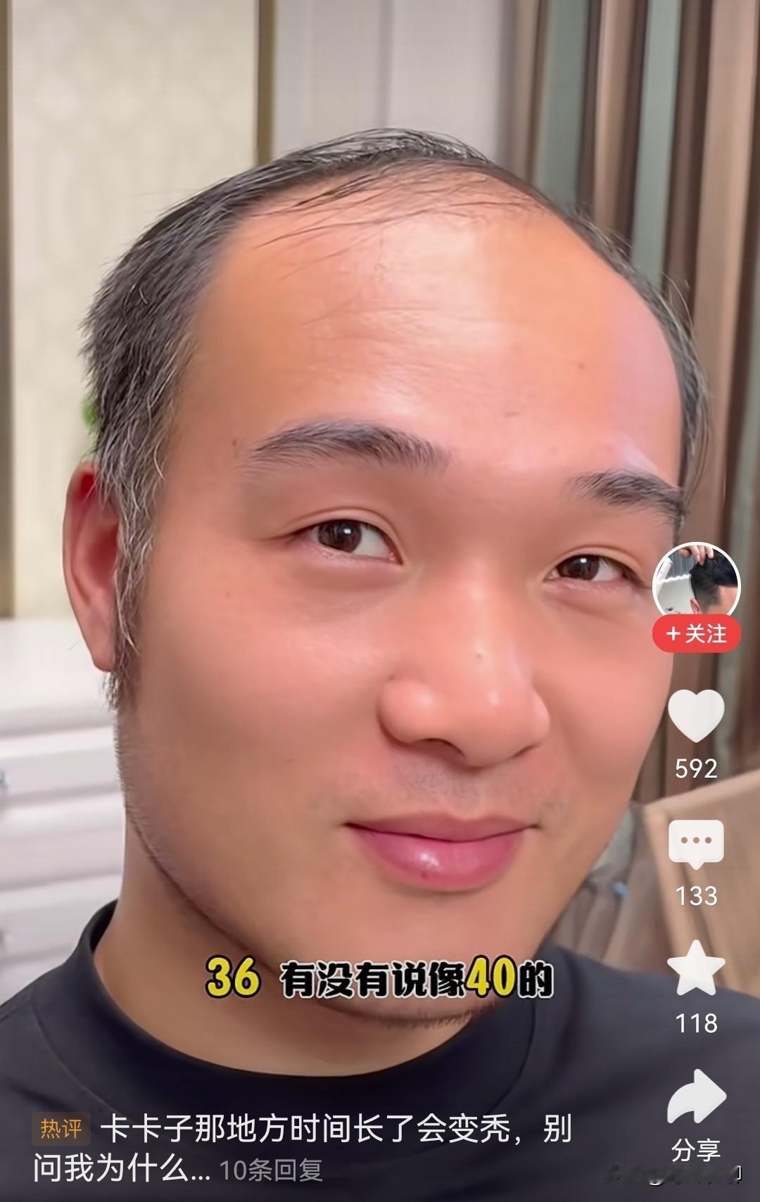 不得不说，这假发还真是好东西，没带之前，看着说40都不为过。可戴上之后，简直就像
