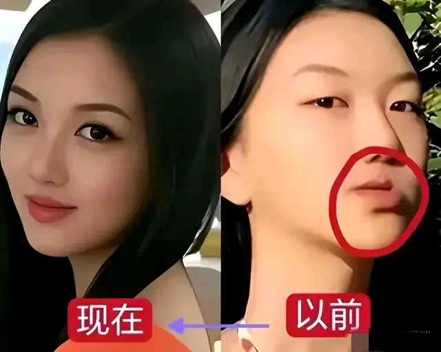 王菲女儿李嫣现身北京某商场,兔唇消失,越来越像王菲