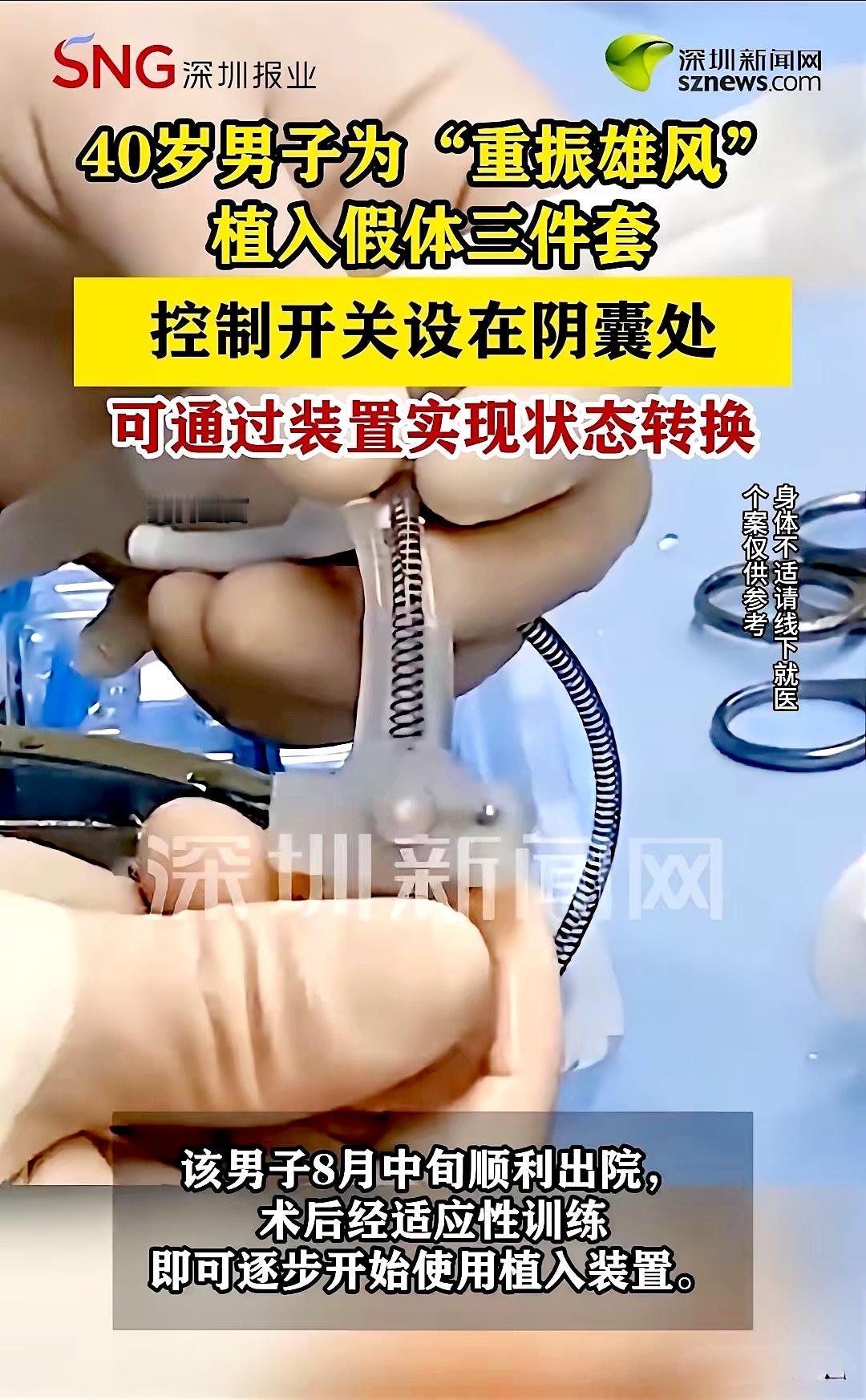 深圳，一名40岁男子看着妻子渴望的眼神，直接让医生给他植入假体三件套。有了这