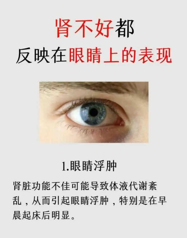 肾脏健康不佳，眼睛会出现这些表现