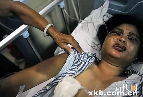 2011年，一女子睡梦中被打晕，接下来长达四个小时，一场酷刑式家暴正式上演，施暴