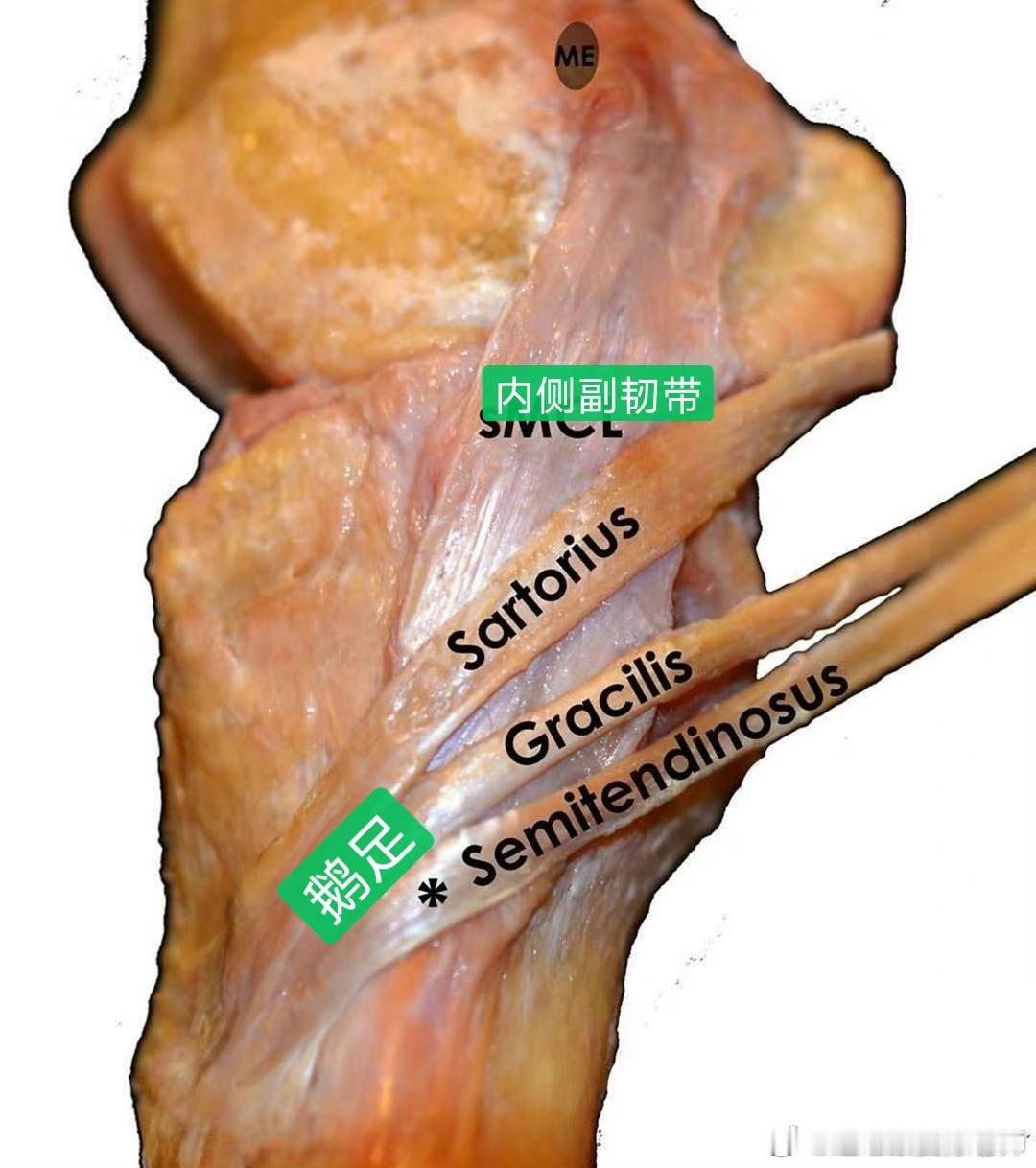 【酸痛、刺痛、针扎痛】困扰你的各种膝盖疼究竟是什么？今天从具体的症状，来讲讲膝关