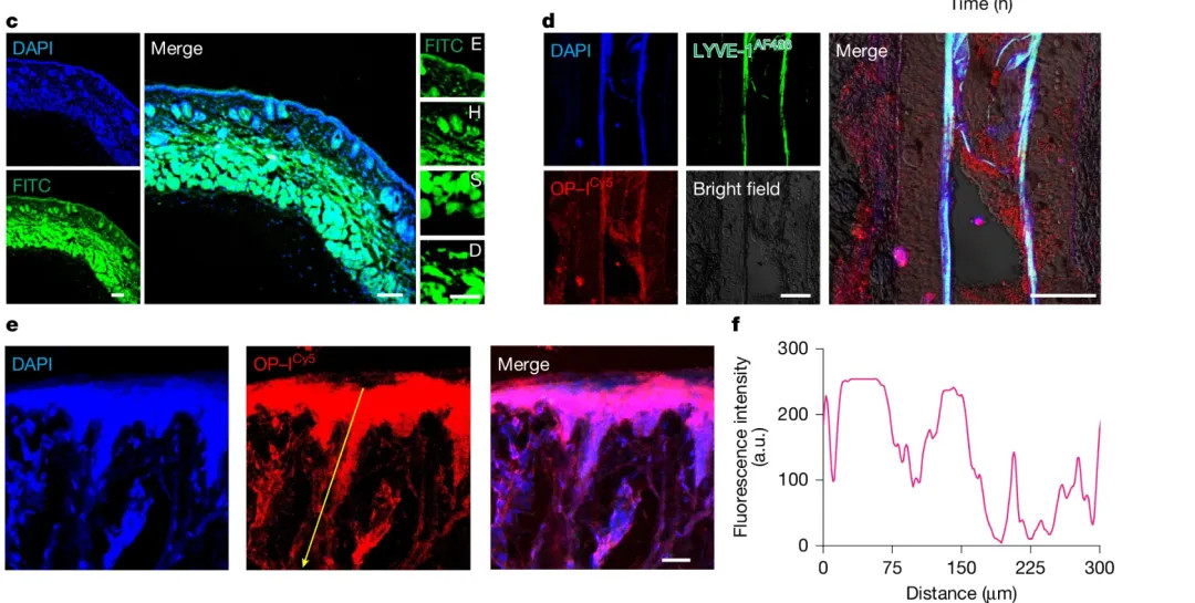 【胰岛素或实现无创皮肤给药】糖尿病患者有望告别针头！浙江大学研究团队在《自然》上