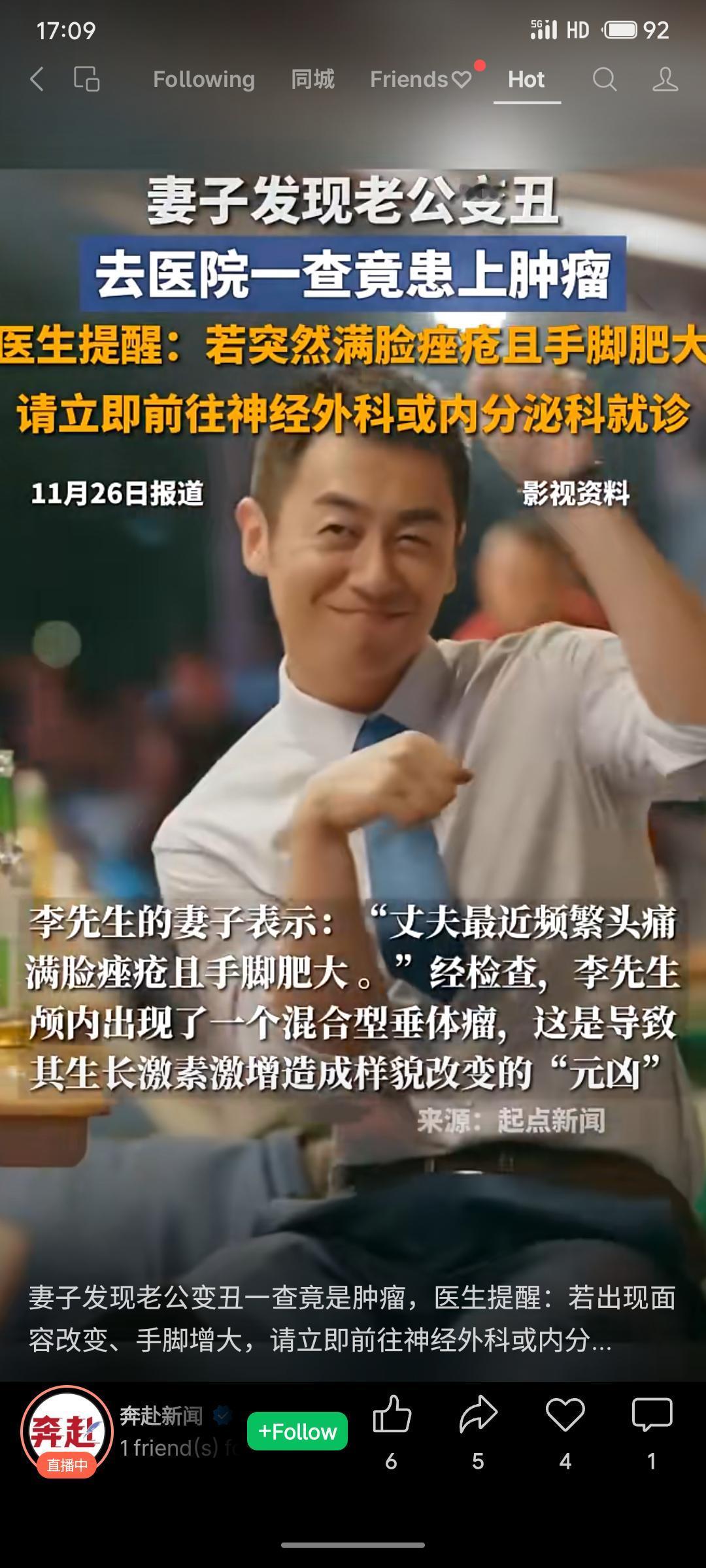 一男子因面容变丑、手脚肥大就医，被诊断出颅内垂体瘤。该肿瘤导致生长激素激增引发外