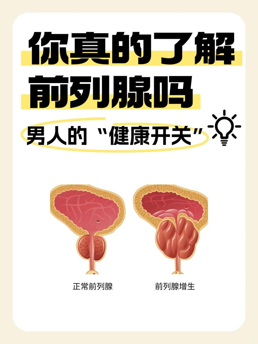 前列腺“自闭罢工”！保养3件套赶紧码住~