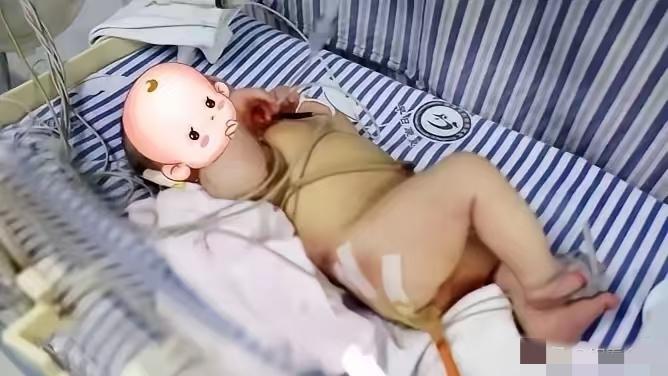 29岁产妇顺产下足月男婴，全家还没来得及高兴，接产医生一翻裤裆当场愣住：孩子屁股