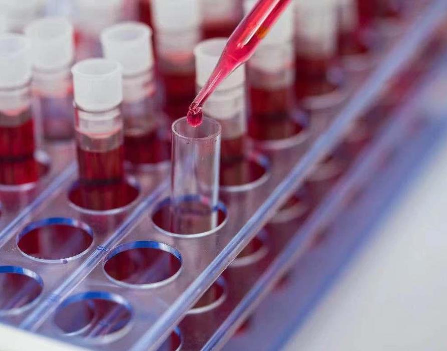 37岁杭州女子确诊艾滋病，流泪坦言：早有异常，当时没重视！一说起艾滋病，很多